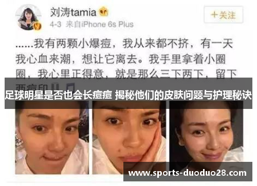 足球明星是否也会长痘痘 揭秘他们的皮肤问题与护理秘诀